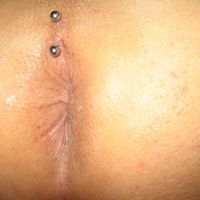 anal piercing